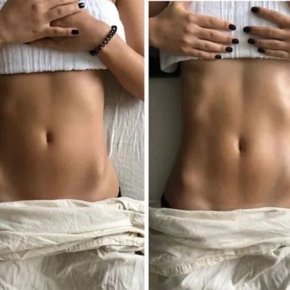 Brazilian-Sculpting-Lymphatic-Drainage-Massage - Natural Touch Training™ - Premier Training & Accreditation in Massage, Beauty, Wellbeing and Personal Development in the UK